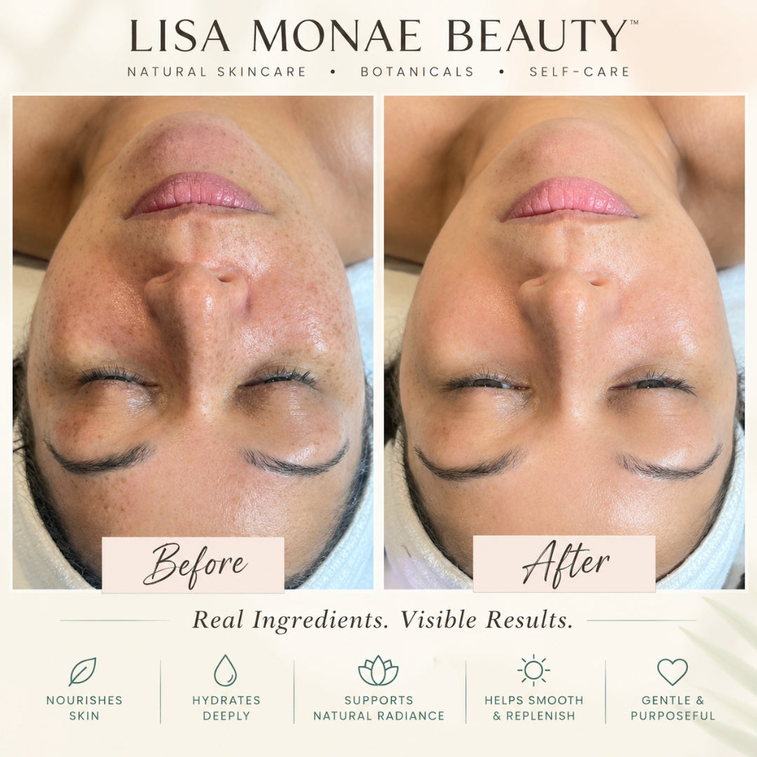 Lisa Monae Beauty branded skincare graphic with side-by-side facial photos labeled Before and After.